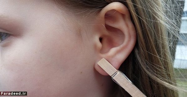 تسکین درد با گیره لباس!