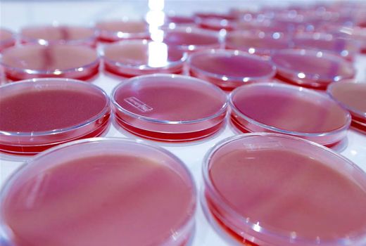 تولید فرآورده بیولوژیک همولیزین در مؤسسه تحقیقات واکسن و سرم سازی رازی